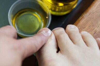 Fungal treatment