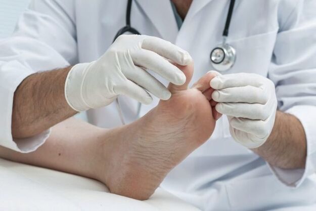 foot fungus diagnosis by a doctor